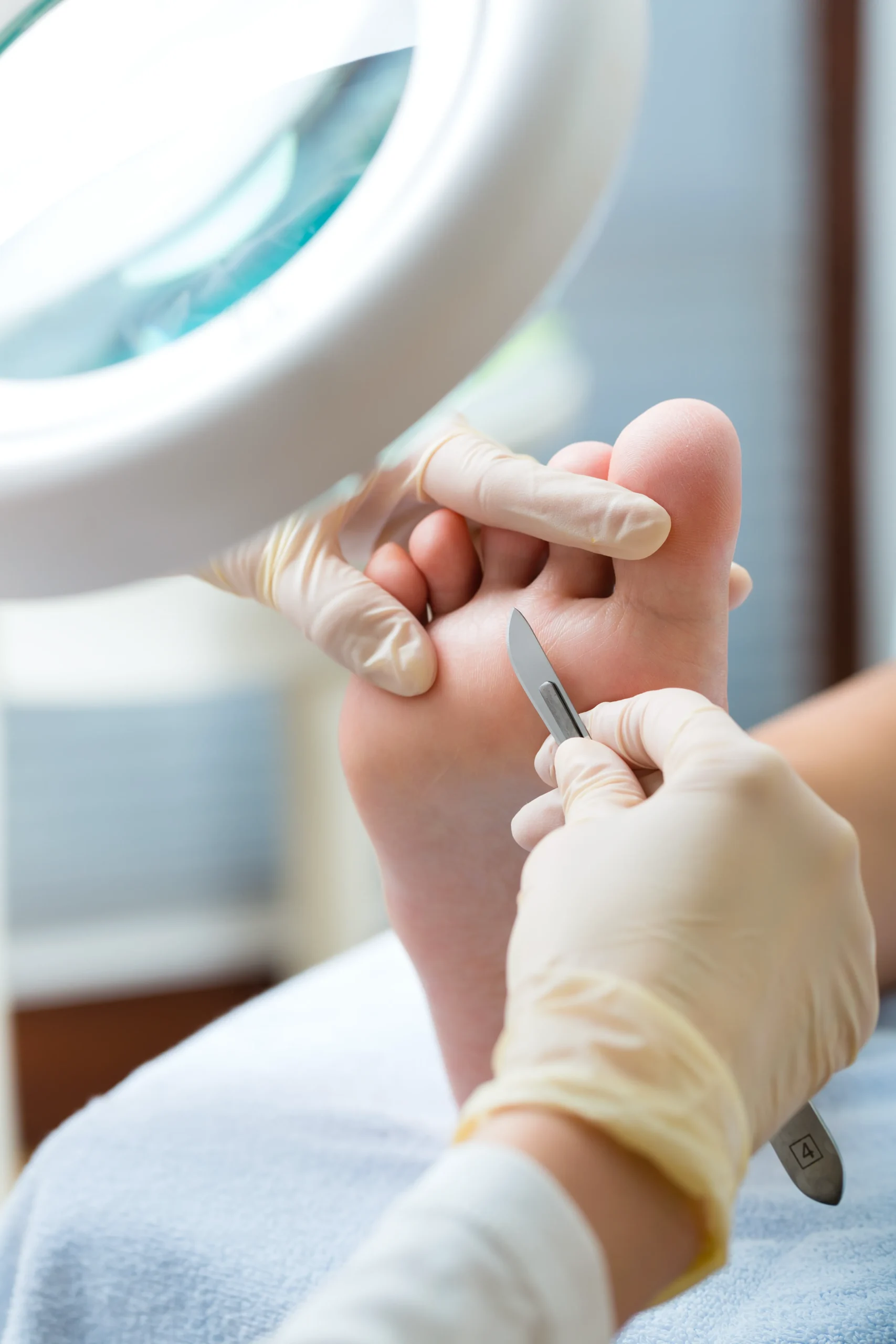 Tratamiento podológico en Málaga · Especialistas en salud del pie